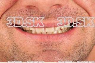 Teeth texture of Gene 0001